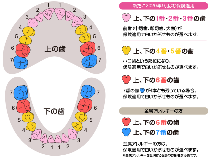 CAD/CAM冠ってどういうもの？ - あいあーる｜恵比寿駅東口医院